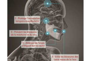 5 raisons de porter un protège-dents